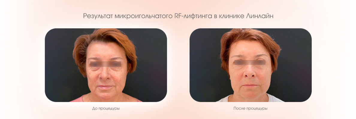 721a0d06-1b9f-4185-bf17-068766d4f8be.PNG